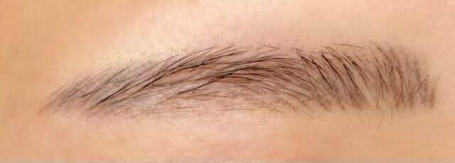 2回目施術から10か月後の右眉の写真（自然に馴染んだ仕上がり）