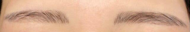 2回目施術から10か月後の眉の写真（自然に馴染んだ仕上がり）